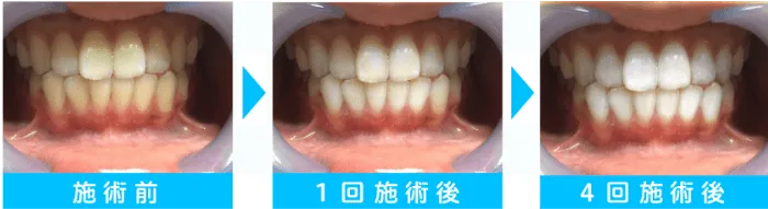 20代 女性・大学生